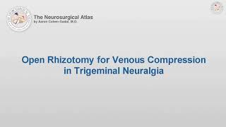 Microsurgical Forceps Rhizotomy for Questionable Venous or no Vascular Compression (Preview)