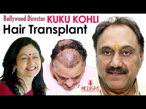 12 Bollywood Celebs Before And After Hair Transplantation  YouTube