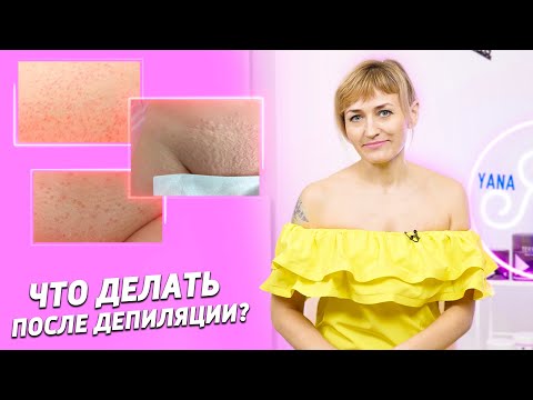 Видео: Как обезболить кожу: 6 шагов (с иллюстрациями)