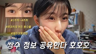 투머치토커가 쌍수 썰 풀면?😉 완전 럭키비키한 세미아웃라인 vlog❤️