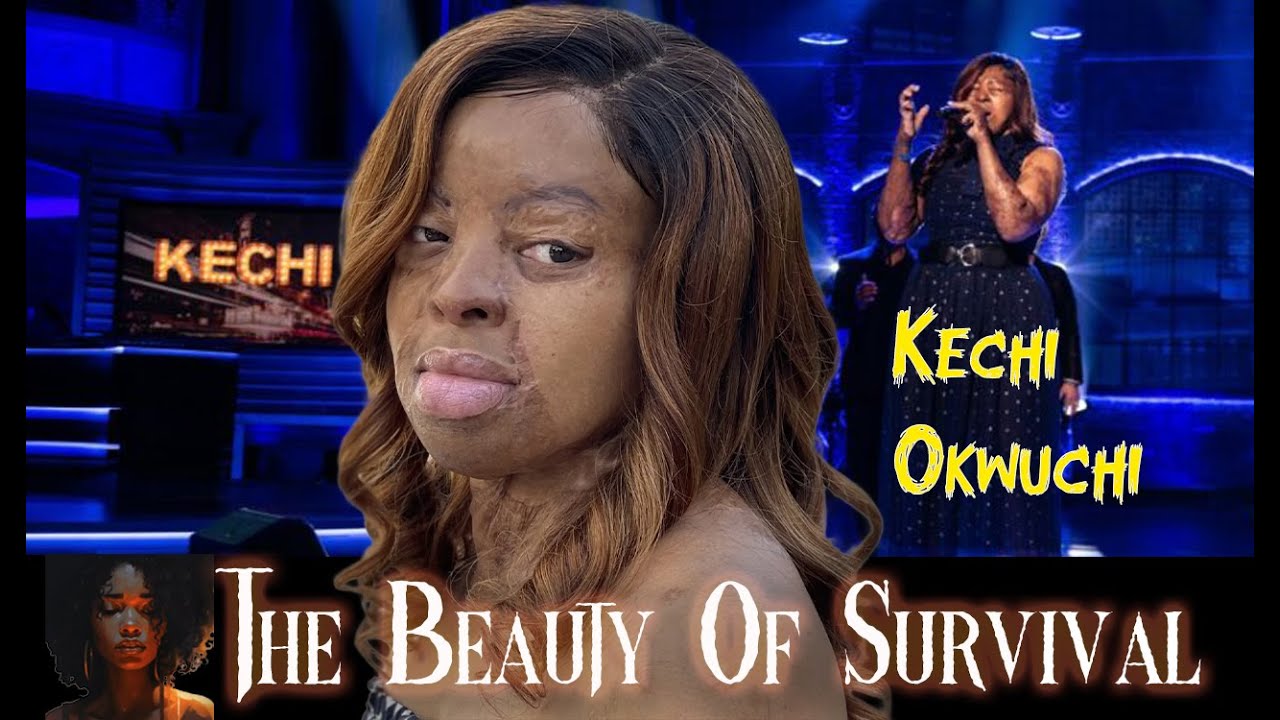 More Than Her Scars The Kechi Okwuchi Story YouTube
