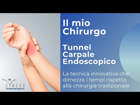 TUNNEL CARPALE IN ENDOSCOPIA La tecnica innovativa che dimezza i tempi della chirurgia tradizionale