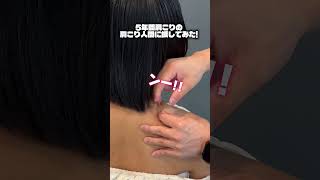 5年間放置した肩こりを鍼でとってみた! #整体 #鍼治療 #肩こり #鍼