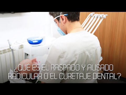 Video: En odontología ¿qué es el raspado?