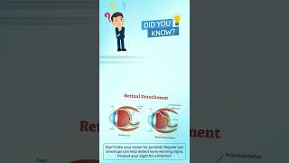 🚨 Retinal Detachment: A Silent Threat to Your Vision! 👁️