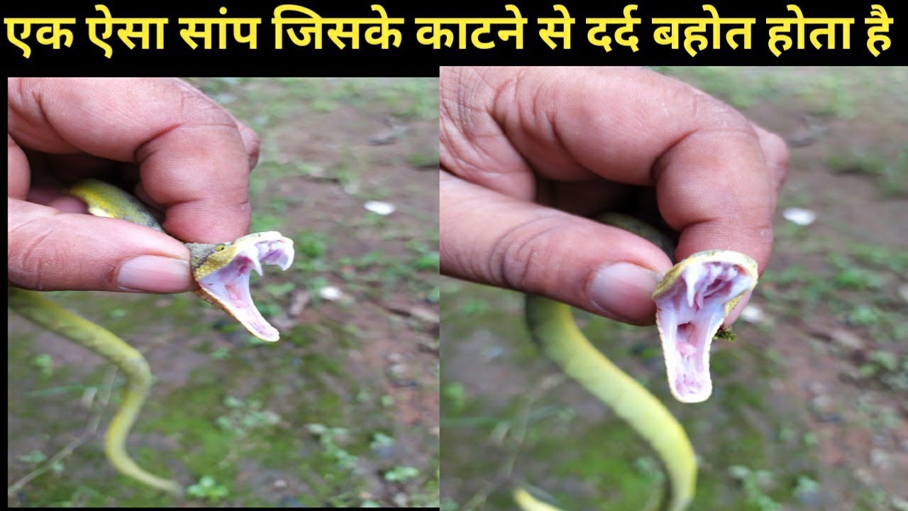 snake bite treatment india एक ऐसा सांप जिसके काटने से दर्द बहोत होता है | Dangerouse Painful Bites Snake