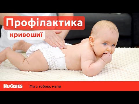 Профилактика кривошеи у ребенка | Массаж для грудничков | Развитие ребенка | Советы родителям