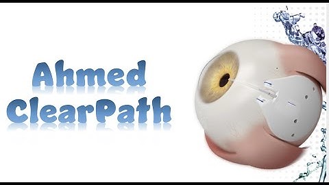 AHMED ClearPath Implant