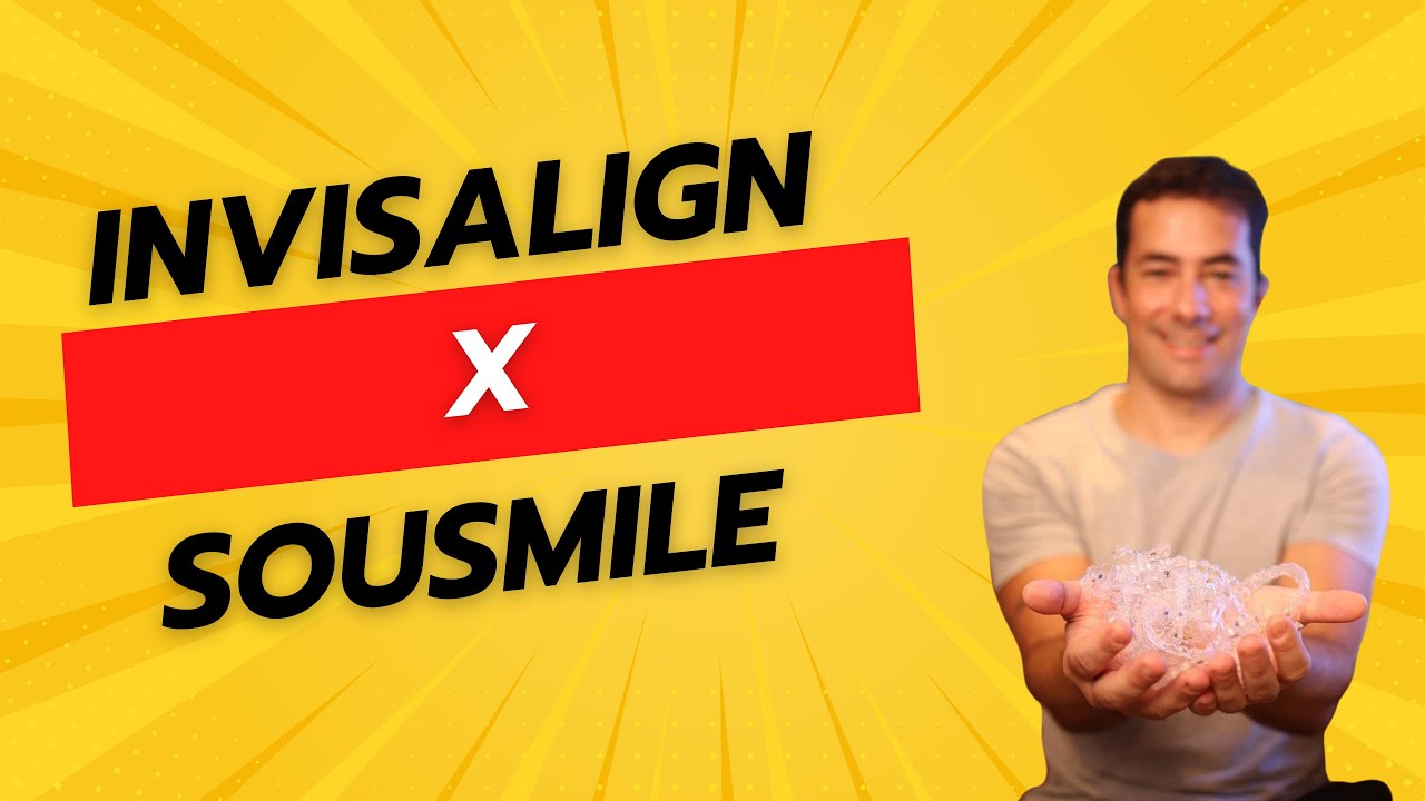 "Invisalign x Sousmile: Qual é o Melhor Alinhador para Você?"