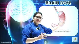 BRAIN DOSE - Cardiac (gastroesophageal) Sphincter