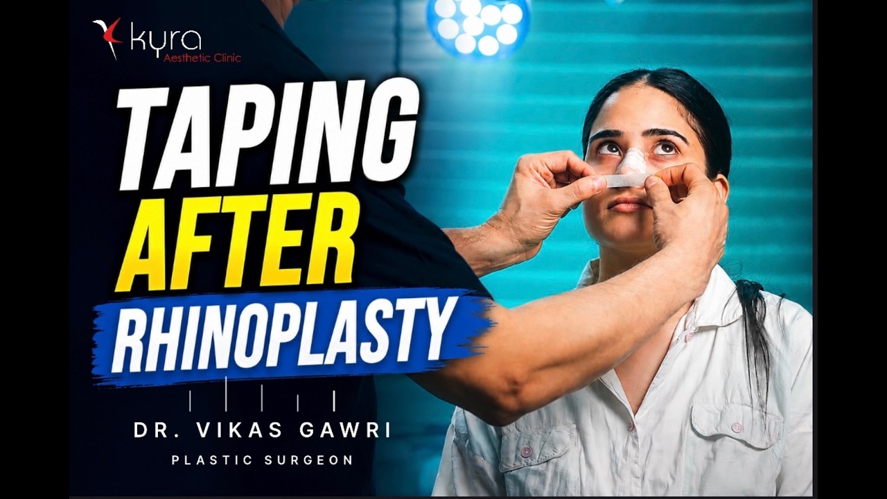 Nose Taping after Rhinoplasty
