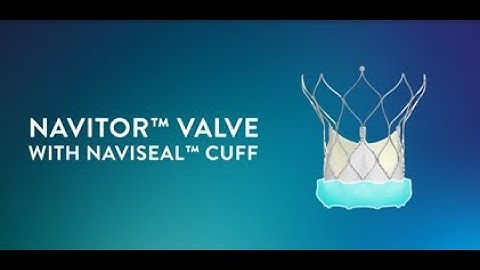 Navitor Valve with NaviSeal Cuff in Action Video