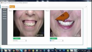 Logiciel laboratoire de prothese dentaire screenshot 1