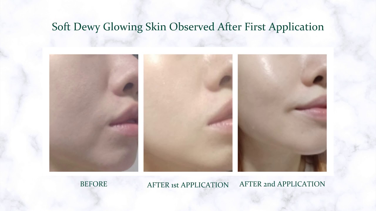 How To Wash Off Skin Damage and Achieve The Skin You Desire YouTube