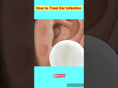 Ear Pain Relief Walgreens