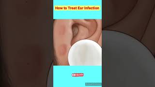How Is Ear Infections Treated?