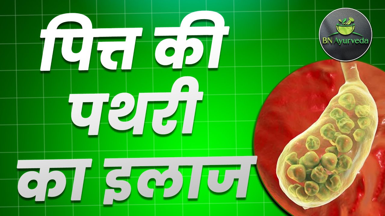 पित्ताशय की पथरी Pit Ki Pathri Ka Ilaj पित्त की पथरी का इलाज - YouTube