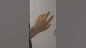 صور ايدين مجروحه كأنها لك 