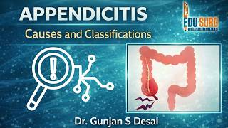 Acute Appendicitis Explained Causes Natural History and Classification
