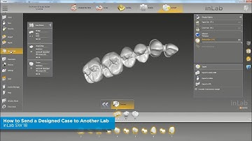 inLab SW 18: How to Send a Designed Case to Another Lab