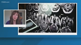 The difference between dementia and Alzheimer's, and how to reduce stigma