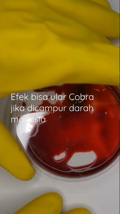Efek Bisa Ular Dalam Darah