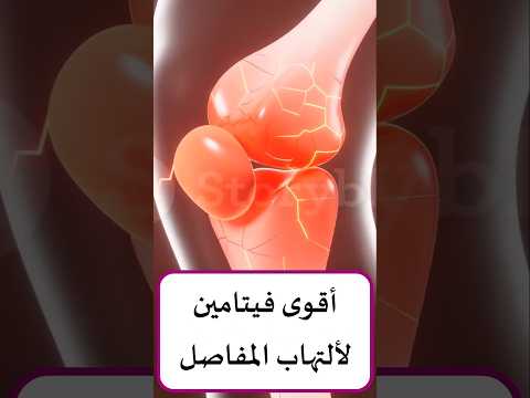 تناول منه يجعل التهاب المفاصل صفر أقوى فيتامين لصحة المفاصل