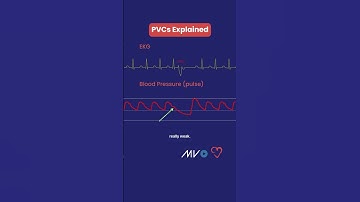 PVCs Explained ❤️⚡️
