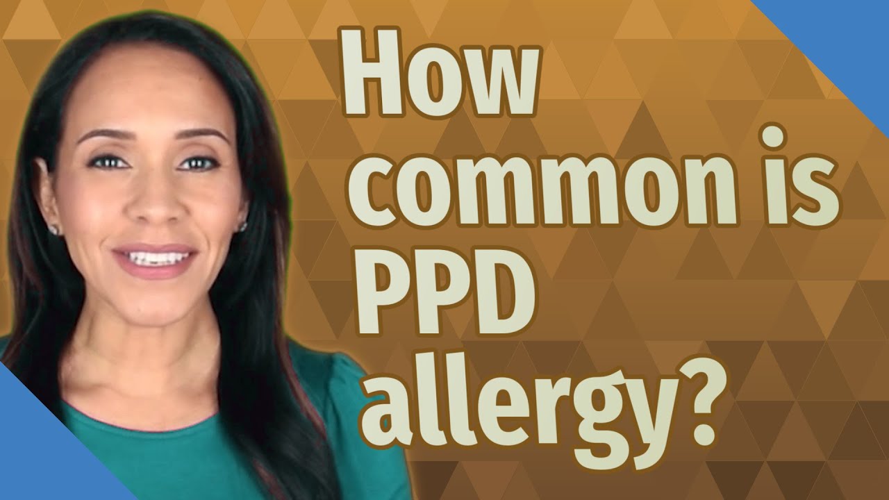 How common is PPD allergy? YouTube
