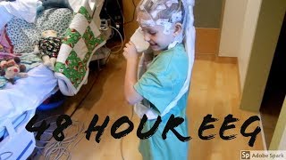 48 Hour EEG