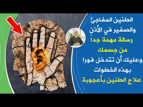 فيديو: ما الذي يسبب صوت جرجلي؟