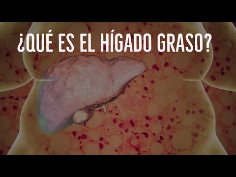 Wideo: Hígado Graso: Qué Es Y Cómo Salir Del Problema