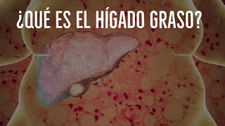 ¿Qué es el hígado graso? (esteatosis hepática no alcohólica)