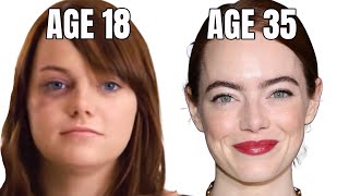 Emma Stone's Incredible Plastic Surgery Transformation