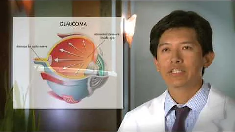 Cataract Surgery Pseudoexfoliation at SightMD | Eye Doctors Eye Surgeons