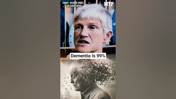 Dementia Is 99% Preventable — Here’s How to Stop It Naturally 🧠💊