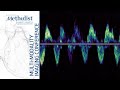 Assessment of the Right Ventricle & Right Sided Valves: Echo (Sherif F. Nagueh MD) February 23, 2021