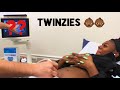 LETS LOOK AT THE TWINS | ULTRASOUND!!!!!