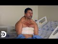 Impresionante cirugía de eliminación de lipomas  | Mi Cuerpo, Mi Desafío | Discovery Latinoamérica