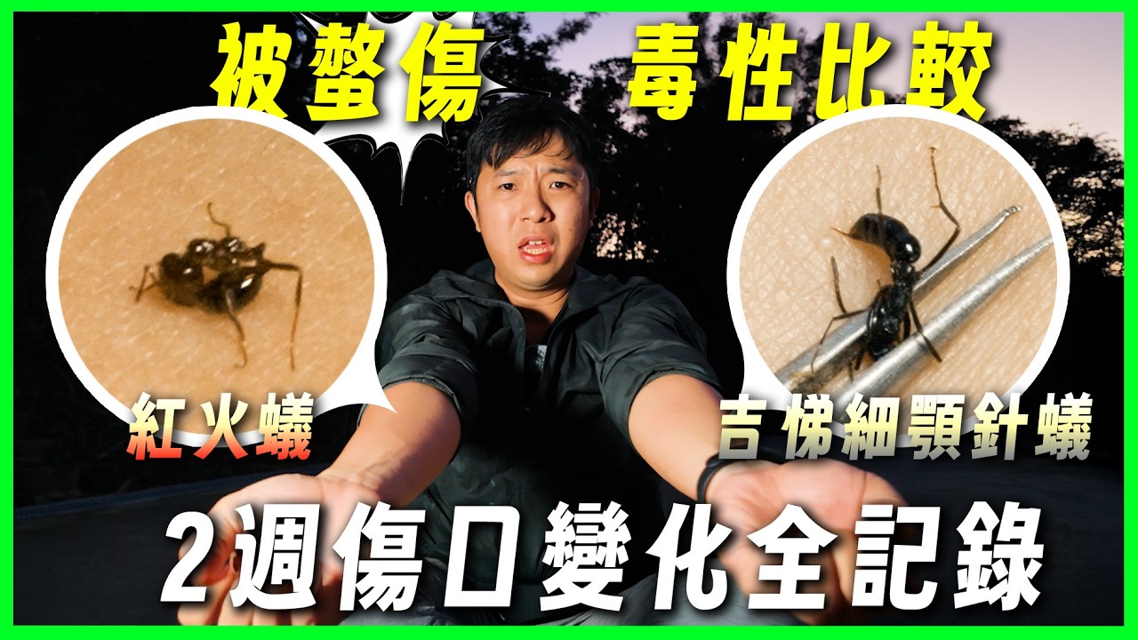 以身試毒!! 給紅火蟻vs吉悌細顎針蟻螫|哪種痛?哪種危險?|2週傷口全記錄【臺灣蟻窟】 - YouTube