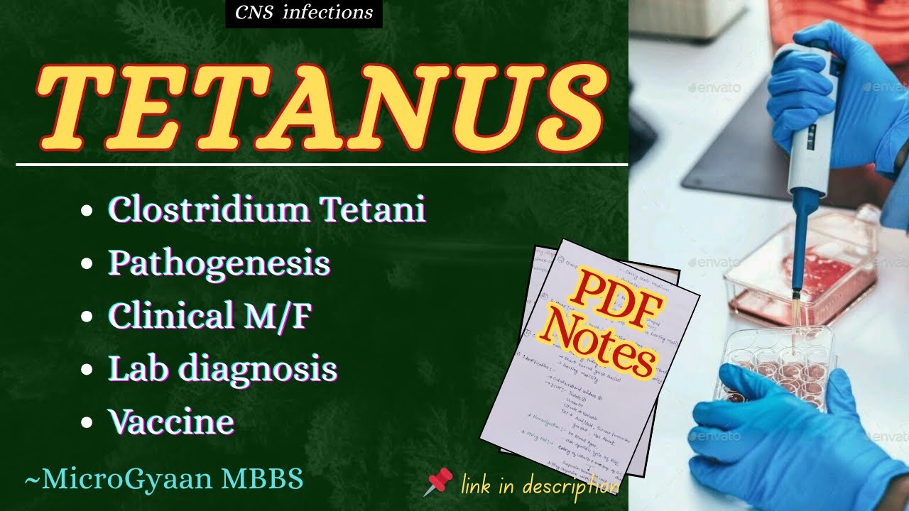 Tetanus in Microbiology | Pathogenesis, Clinical Features & Prevention | CNS infections | MBBS