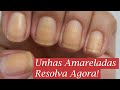 Como tirar Amarelo das Unhas - Dica da Semana