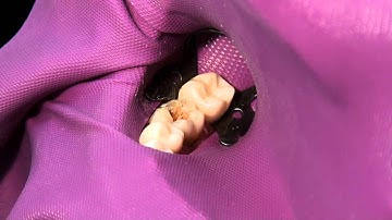 GuttaCore placement technique | Dentsply Sirona