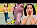 قضيت يوم كامل بدون حذاء مشيت حافيه في الشارع رجلي اتحرقت شوفوا رد فعل الناس
