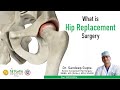 What is hip replacement  dr sandeep gupta   best hip surgeon chandigarh  faith technique