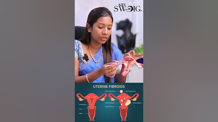 Fibroids இங்க இருந்தா Periods அதிகமா வரும்!  - Dr Nandhini Explains | Periods Problem