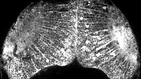 Spontaneous neuronal activity in the brain of a zebrafish larva