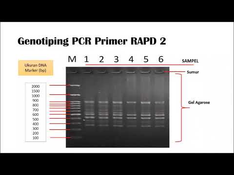 PCR dan Elektroforesis DNA
