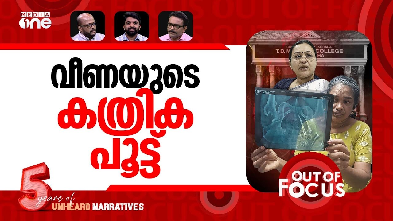 വയറ്റിലെ കത്രികകള്‍ | Scissors left in woman's abdomen after surgery | Out Of Focus
