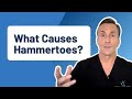 What Is The Main Cause of Hammertoes?